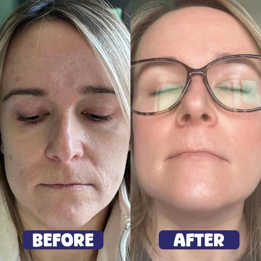 Nivora GlowMask